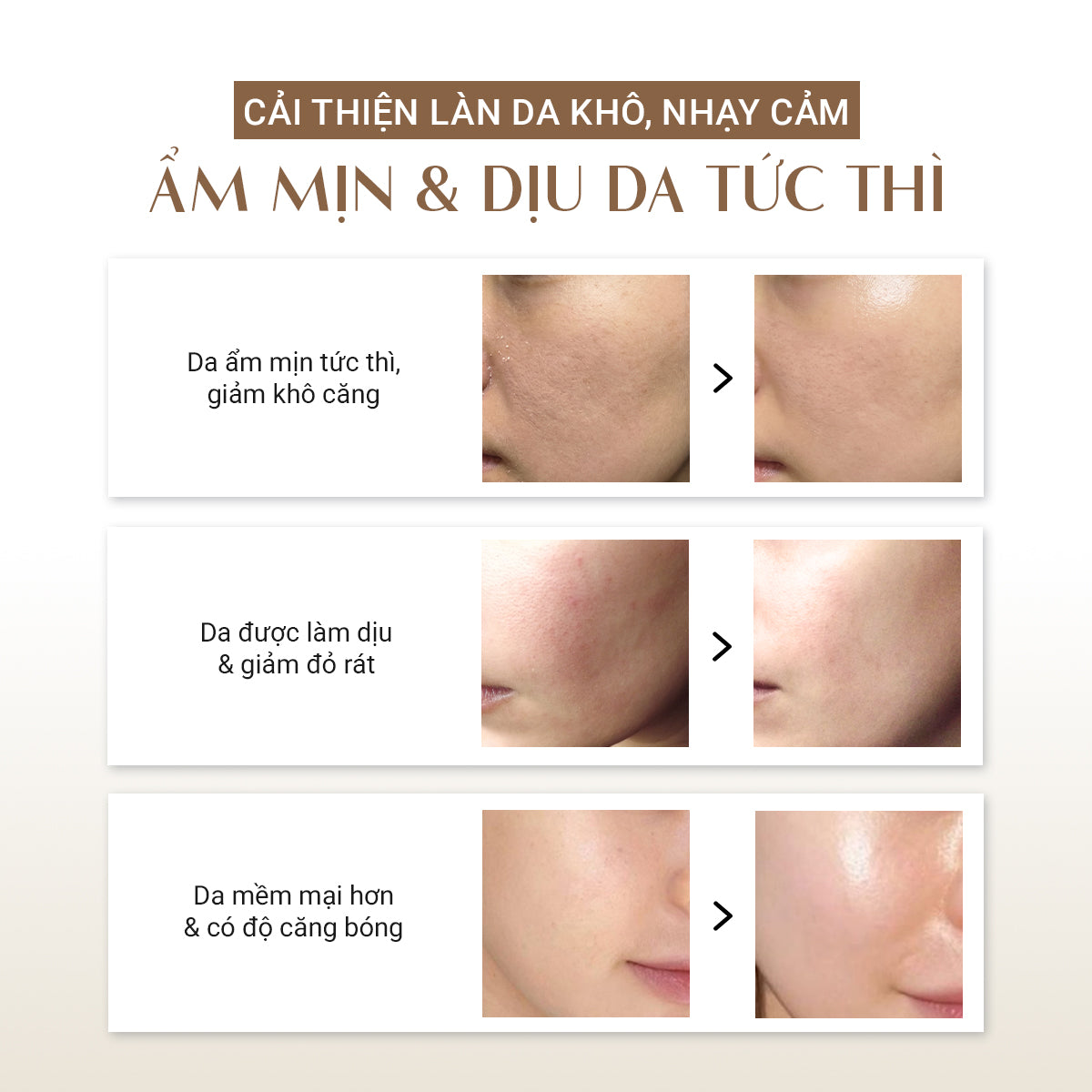 Bộ 3 cấp ẩm & làm dịu da Trouble Calming DaoiDa