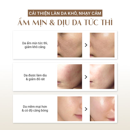 Bộ 3 cấp ẩm & làm dịu da Trouble Calming DaoiDa