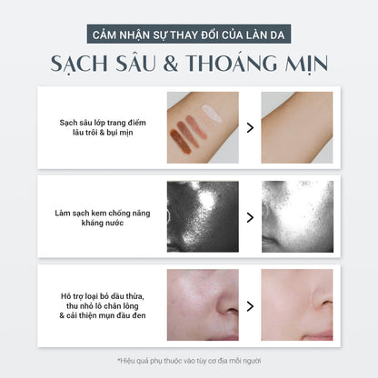(Quà 200k) Kem Tẩy Trang Cải Thiện Mụn Đầu Đen (110g)
