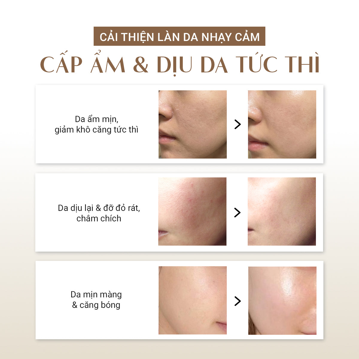 [MỚI] Serum Nhớt Thực Vật Làm Dịu Da 100ML