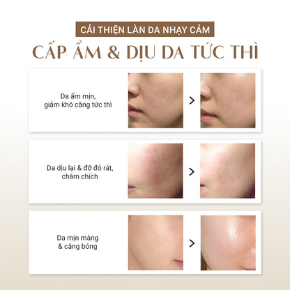 [MỚI] Serum Nhớt Thực Vật Làm Dịu Da 100ML