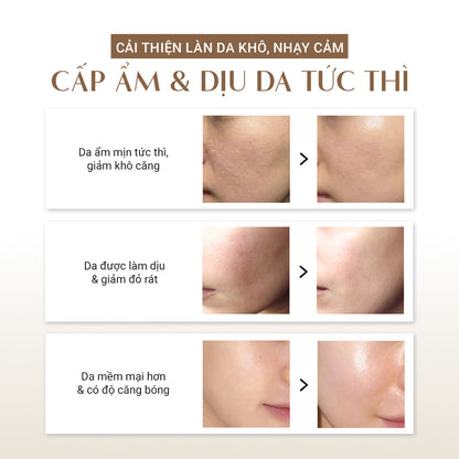 [MỚI] Kem Dưỡng Nhớt Thực Vật Cấp Ẩm & Làm Dịu Da
