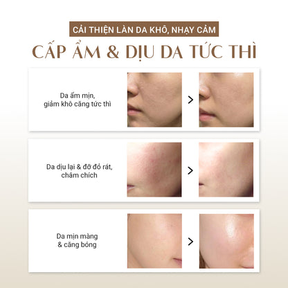 [ĐỘC QUYỀN] Serum Nhớt Thực Vật Làm Dịu Da