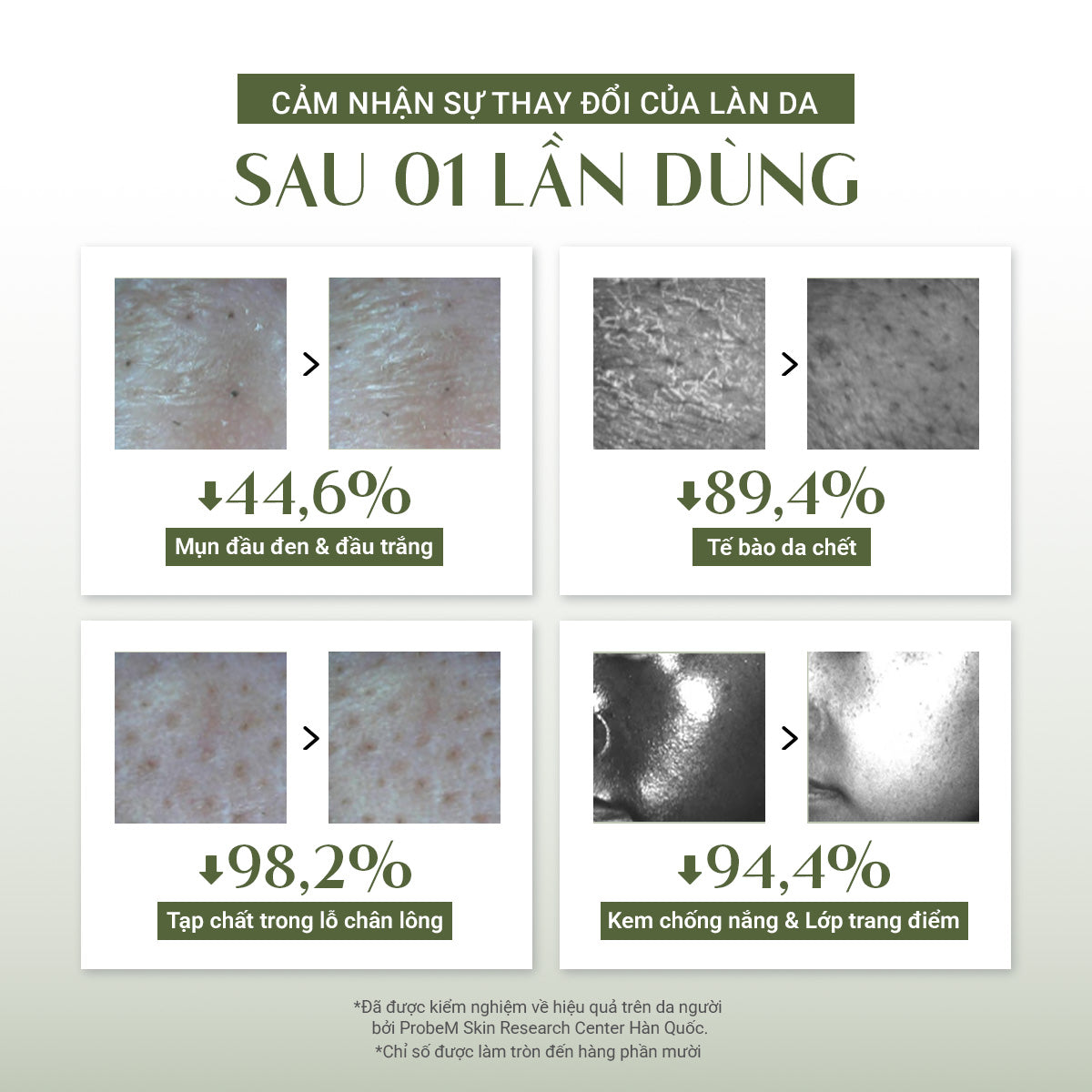 (Quà Tặng 200k) Bánh Rửa Mặt Cải Thiện Mụn Đầu Đen (120g)