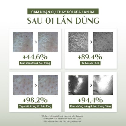 (Quà Tặng 200k) Bánh Rửa Mặt Cải Thiện Mụn Đầu Đen (120g)
