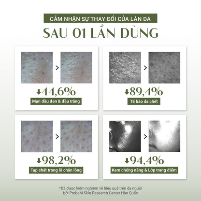 Bánh Rửa Mặt Cải Thiện Mụn Đầu Đen (120g)