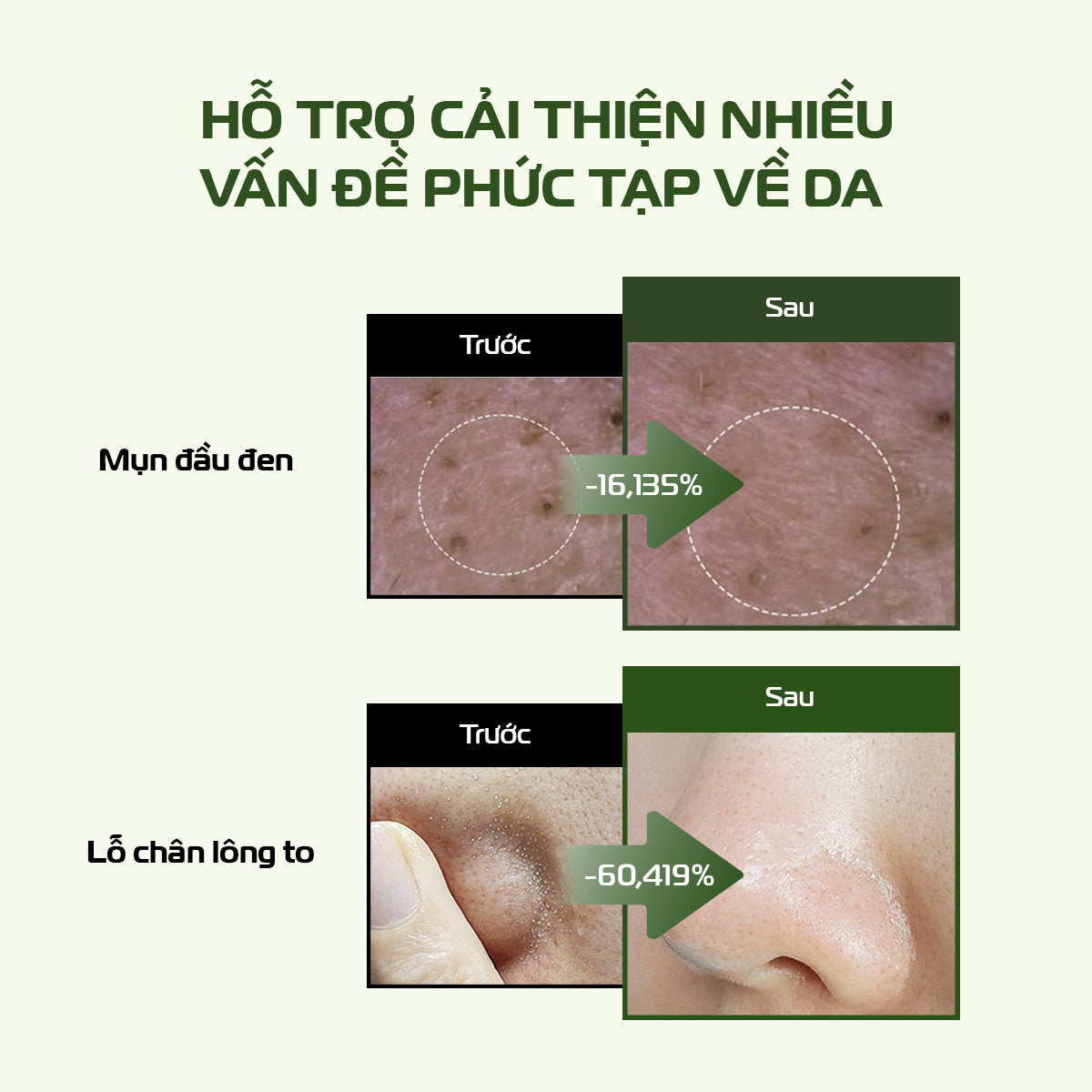 [QUÀ TẶNG FULLSIZE] Combo Kem Tẩy Trang Và Bánh Rửa Mặt