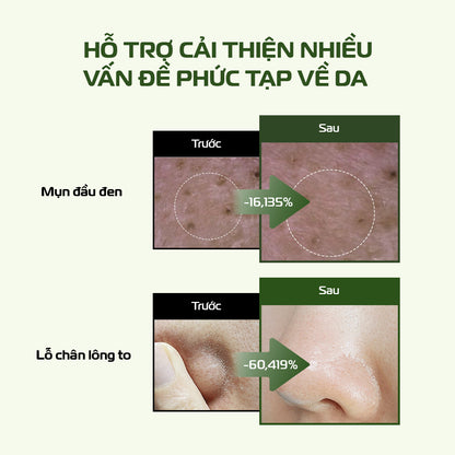 [QUÀ TẶNG FULLSIZE] Combo Kem Tẩy Trang Và Bánh Rửa Mặt