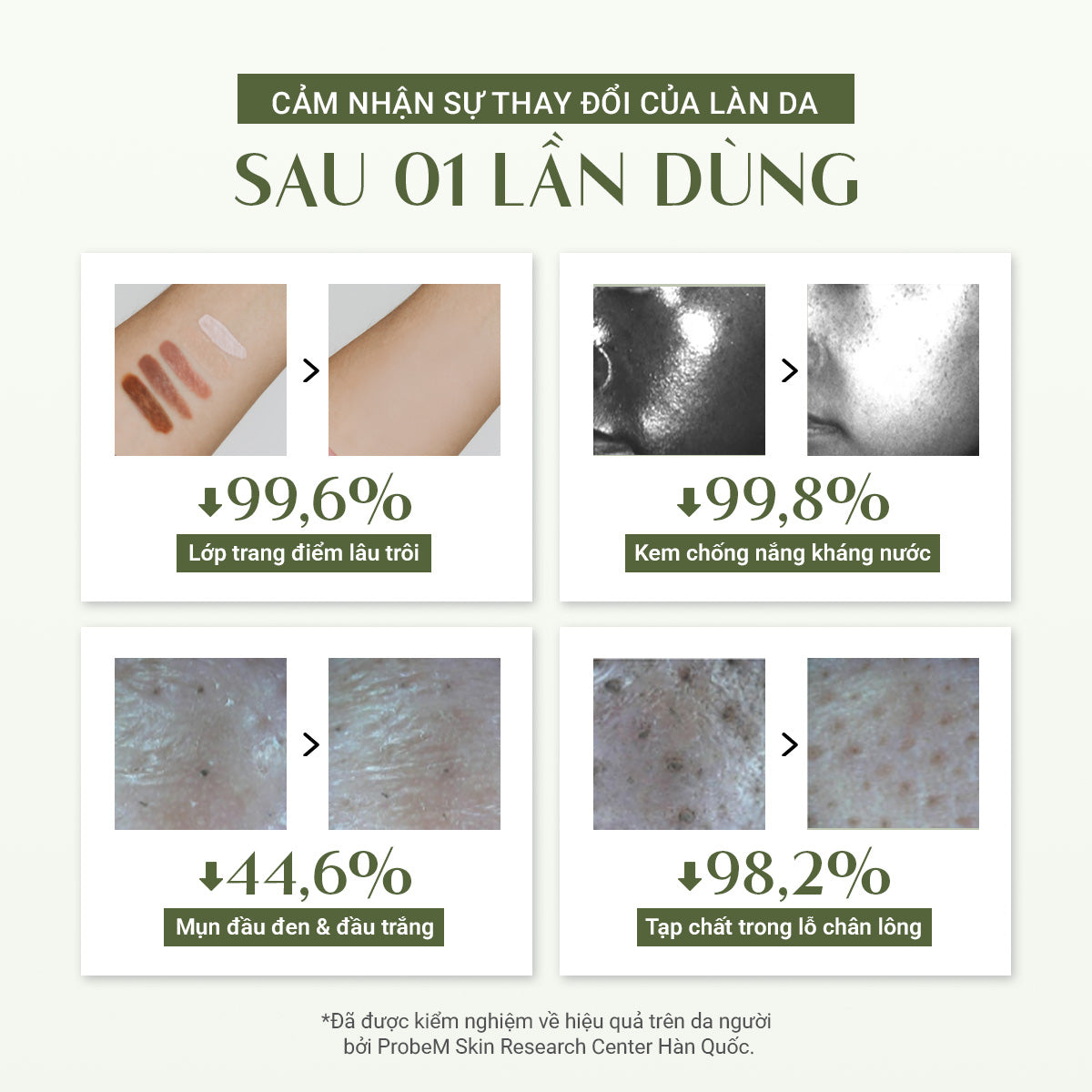 [VOUCHER 200K] Combo 3 Làm Sạch Mụn Đầu Đen & Dưỡng Trắng Căng Bóng