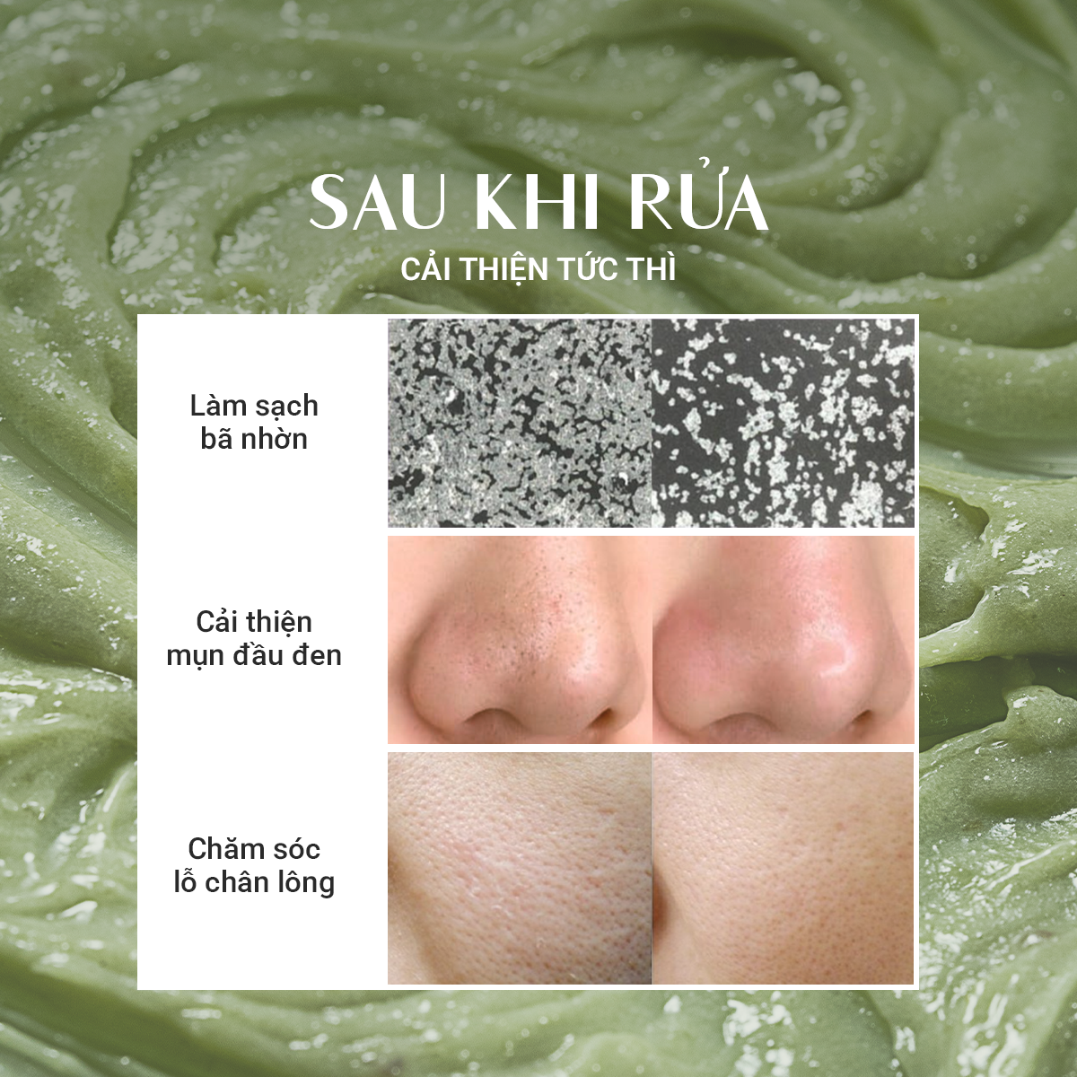 Bánh Rửa Mặt Cải Thiện Mụn Đầu Đen (120g)