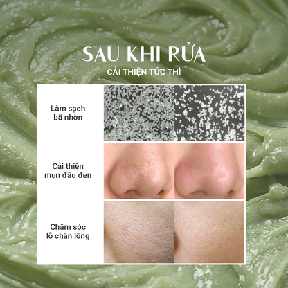 Bánh Rửa Mặt Cải Thiện Mụn Đầu Đen (120g)
